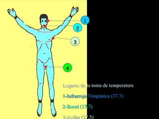 1 2 3 4 Lugares de la toma de temperatura 1-Infrarroja Timpánica (37.7) 2-Bucal (37.7) 3-Axilar (37.5) 4-Rectal (38.3) 