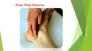 Pulso Tibial Posterior
 
