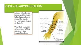 ZONAS DE ADMINISTRACIÓN
Las más utilizadas son:
la vena cefálica media y
la basílica media en la
extremidad superior.
La vena yugular interna
en el cuello.
Venas de la zona distal
del antebrazo: cefálica
accesoria y ante
braquial mediana.
 