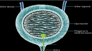 Sonda Foley
Balón Inflado
 