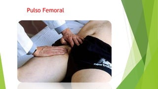 Pulso Femoral
 