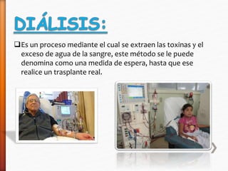 Es un proceso mediante el cual se extraen las toxinas y el 
exceso de agua de la sangre, este método se le puede 
denomina como una medida de espera, hasta que ese 
realice un trasplante real. 
 