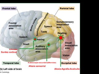 A.Primária
A.associação-secundária(Wernicke)
Surdez cortical
Afasia sensorial
Alexia-Agrafia-Acalculia
 