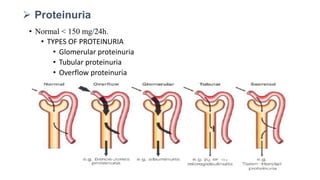 • Normal < 150 mg/24h.
• TYPES OF PROTEINURIA
• Glomerular proteinuria
• Tubular proteinuria
• Overflow proteinuria
 Proteinuria
 