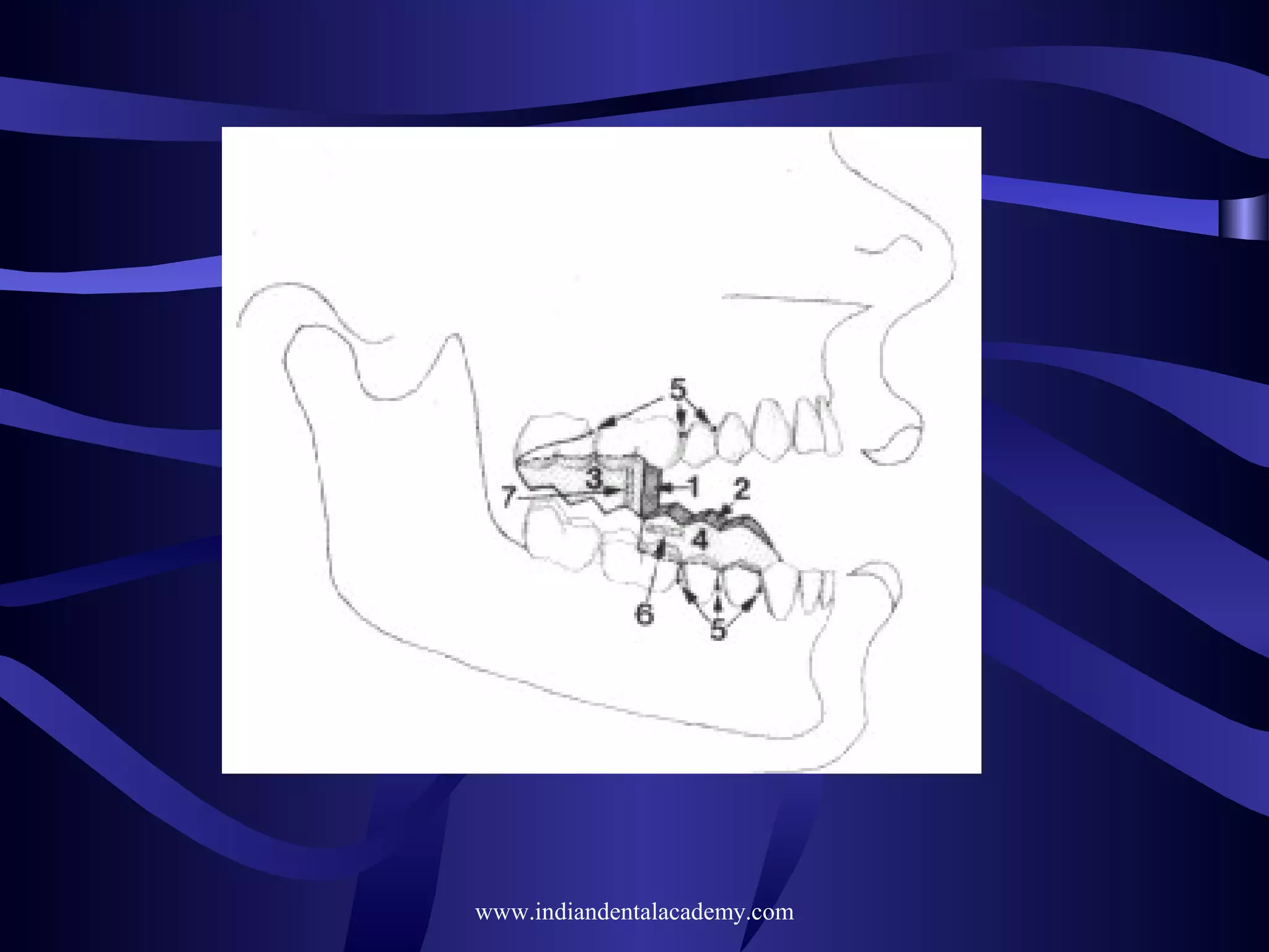 www.indiandentalacademy.com

 