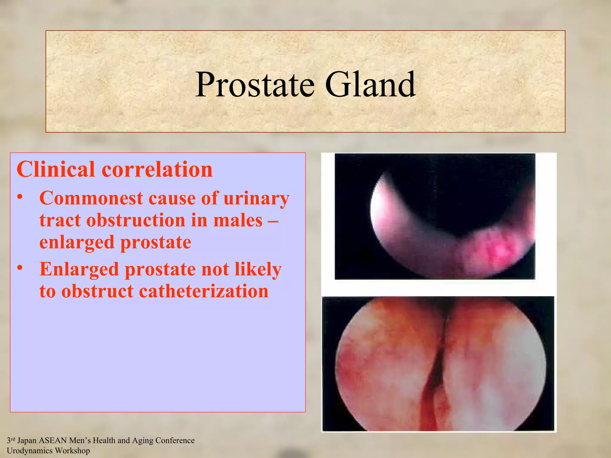 Prostate Gland ‘ Flush of Youth’ Benign Prostatic Hyperplasia sets in at 55 years Compression of prostatic urethra Clinical correlation Commonest cause of urinary tract obstruction in males – enlarged prostate Enlarged prostate not likely to obstruct catheterization 
