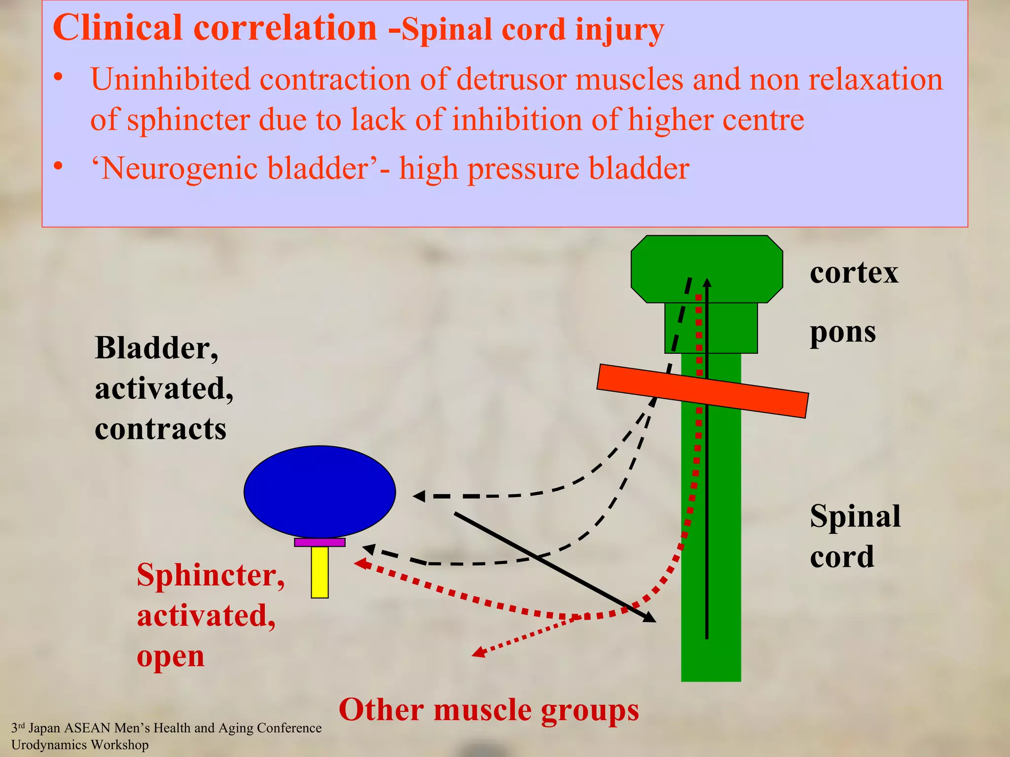 Control of Micturation - input from higher centres Sphincter, activated, open Bladder, activated, contracts cortex pons Spinal cord Other muscle groups Clinical correlation - Spinal cord injury Uninhibited contraction of detrusor muscles and non relaxation of sphincter due to lack of inhibition of higher centre ‘ Neurogenic bladder’- high pressure bladder 