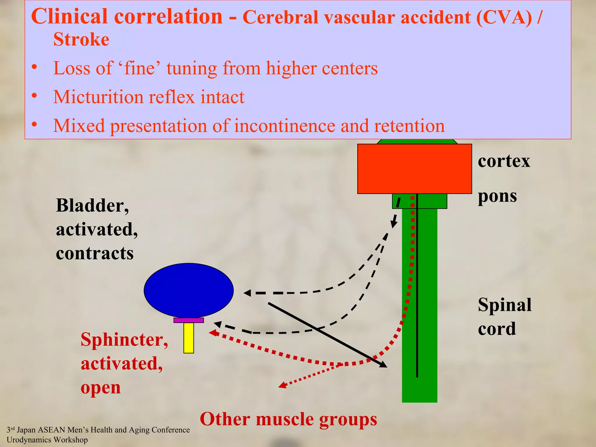 Control of Micturation - input from higher centres Sphincter, activated, open Bladder, activated, contracts cortex pons Spinal cord Other muscle groups Clinical correlation -  Cerebral vascular accident (CVA) / Stroke Loss of ‘fine’ tuning from higher centers Micturition reflex intact Mixed presentation of incontinence and retention 