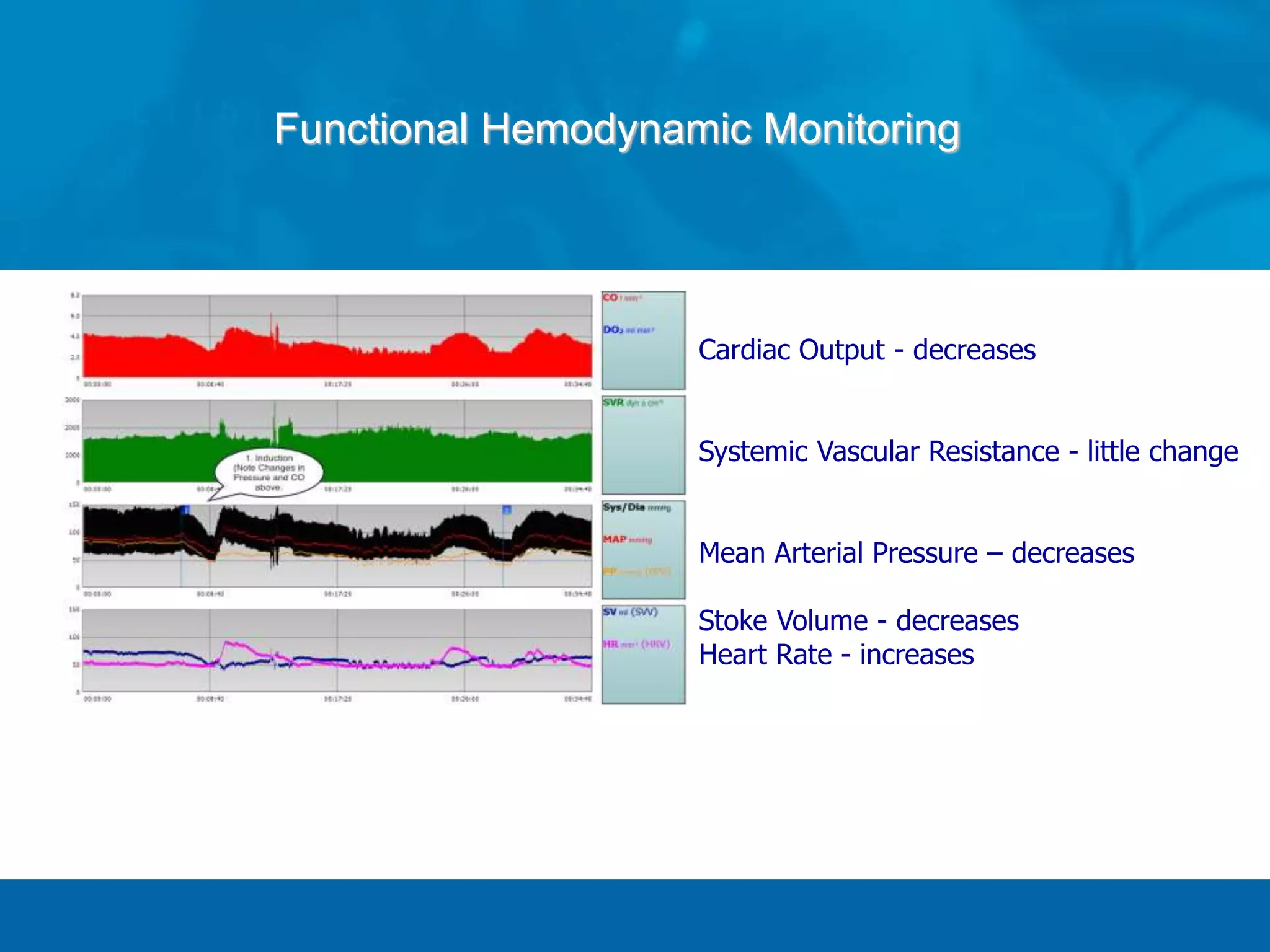 Functional Hemodynamic Monitoring
Cardiac Output - decreases
Systemic Vascular Resistance - little change
Mean Arterial Pressure – decreases
Stoke Volume - decreases
Heart Rate - increases
 