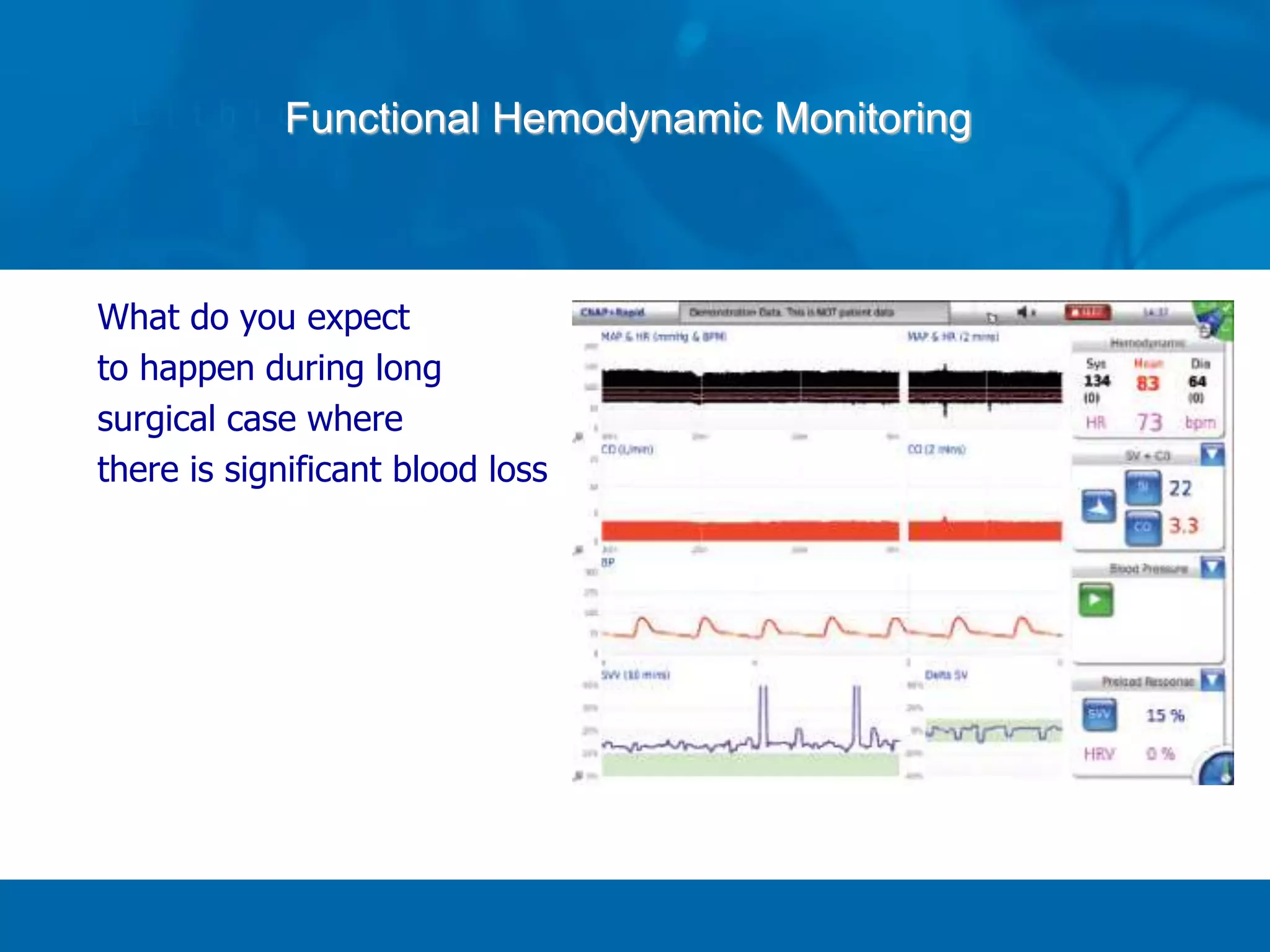 Functional Hemodynamic Monitoring
What do you expect
to happen during long
surgical case where
there is significant blood loss
 