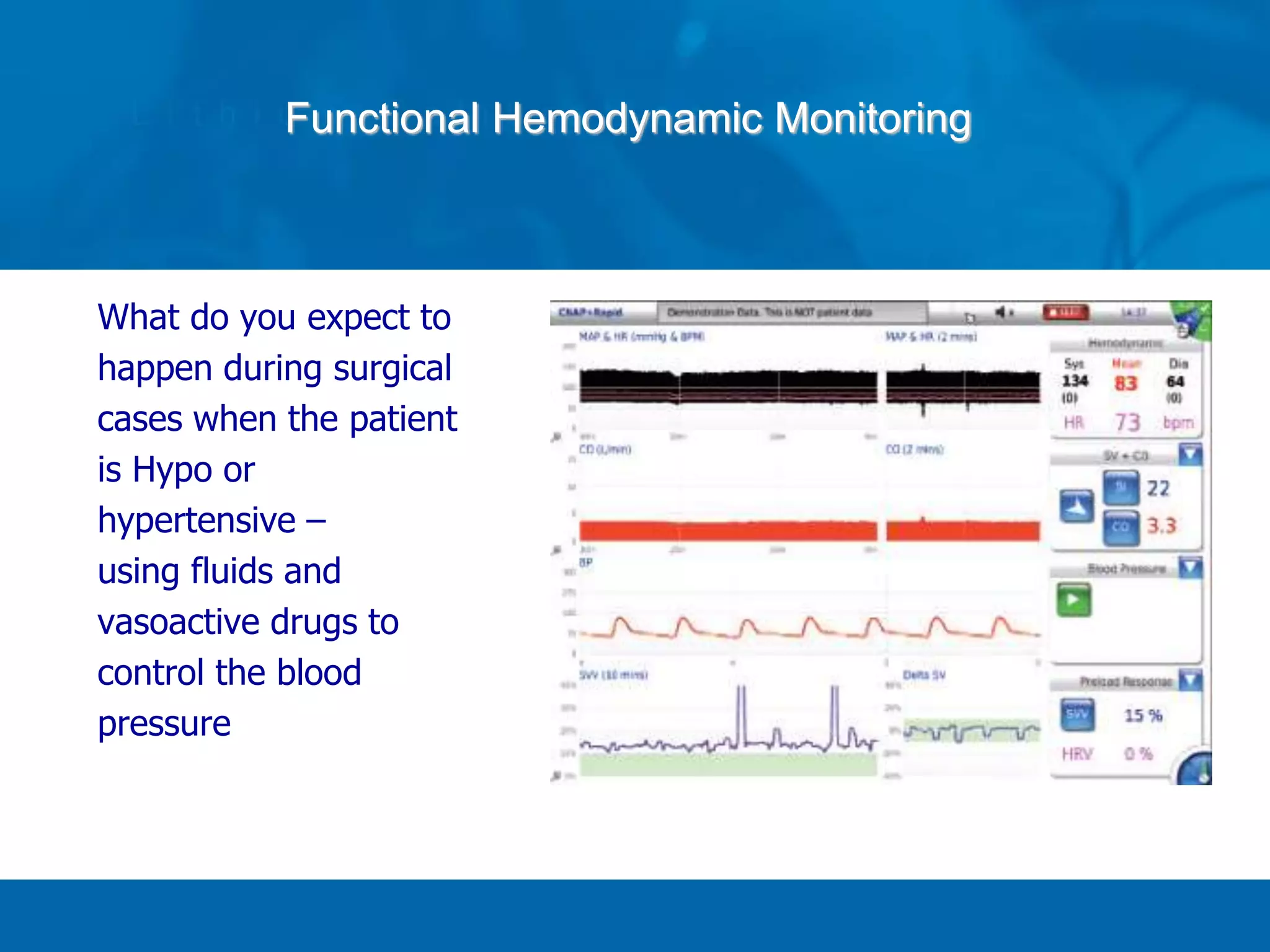 Functional Hemodynamic Monitoring
What do you expect to
happen during surgical
cases when the patient
is Hypo or
hypertensive –
using fluids and
vasoactive drugs to
control the blood
pressure
 