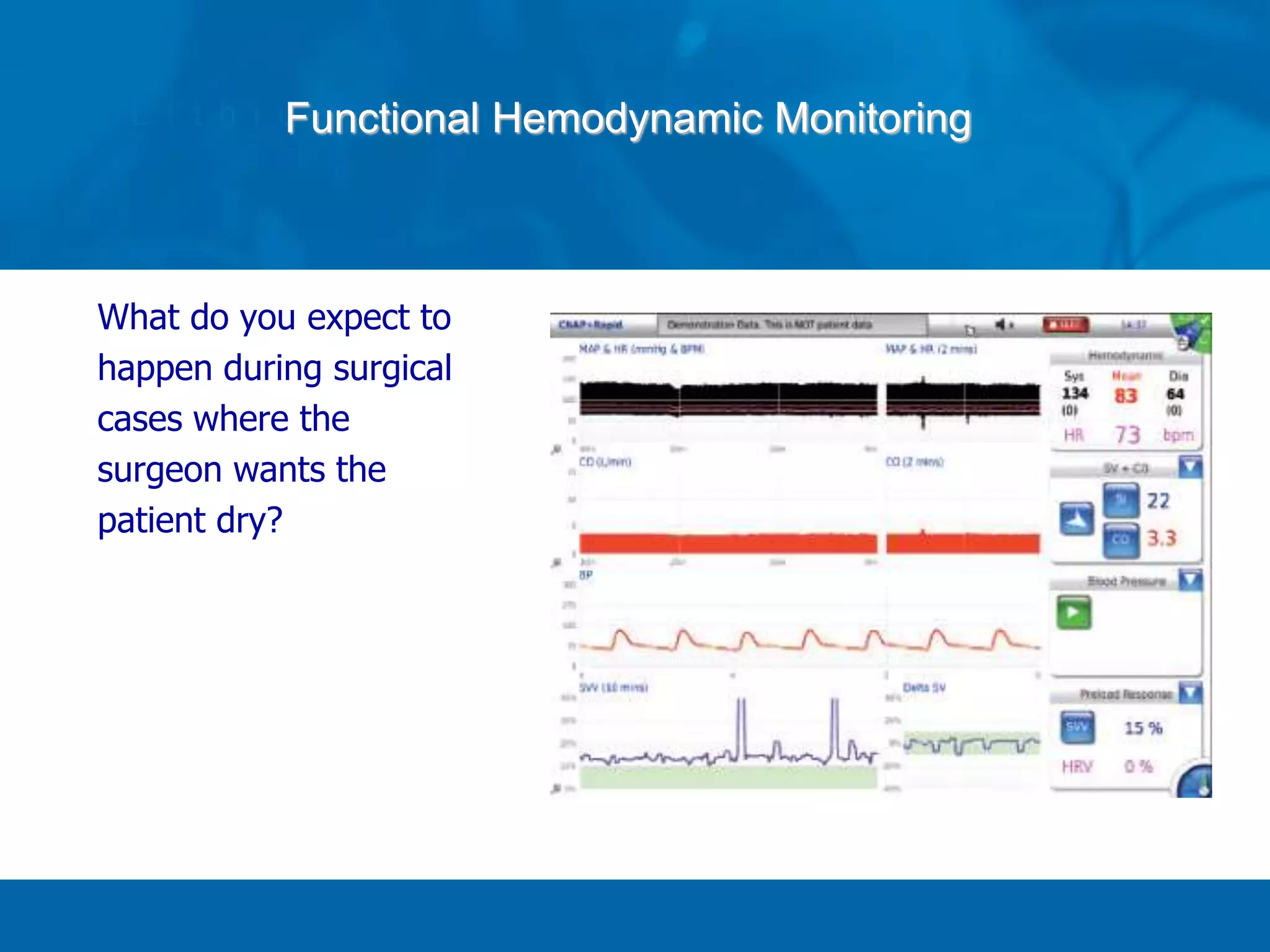 Functional Hemodynamic Monitoring
What do you expect to
happen during surgical
cases where the
surgeon wants the
patient dry?
 