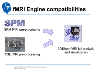 Fmri Tools Functional Magnetic Resonance Imaging Analysis-3765 | PPT