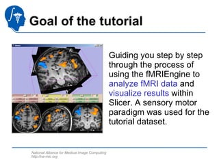 Functional Magnetic Resonance Imaging Analysis-3765 | PPT