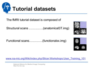 Functional Magnetic Resonance Imaging Analysis-3765 | PPT