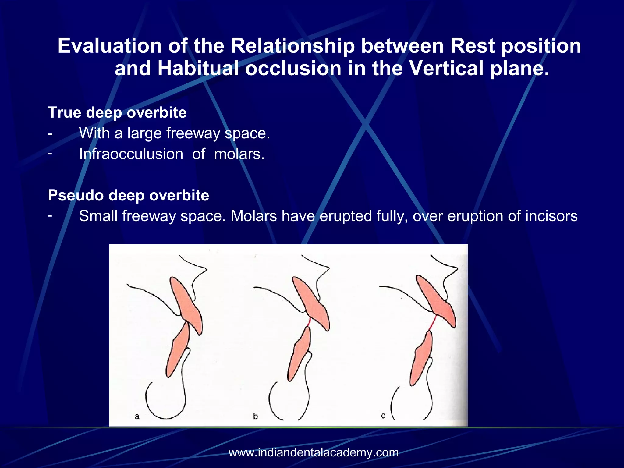 Evaluation of the Relationship between Rest position
and Habitual occlusion in the Vertical plane.
True deep overbite
With a large freeway space.
Infraocculusion of molars.
Pseudo deep overbite
Small freeway space. Molars have erupted fully, over eruption of incisors

www.indiandentalacademy.com

 