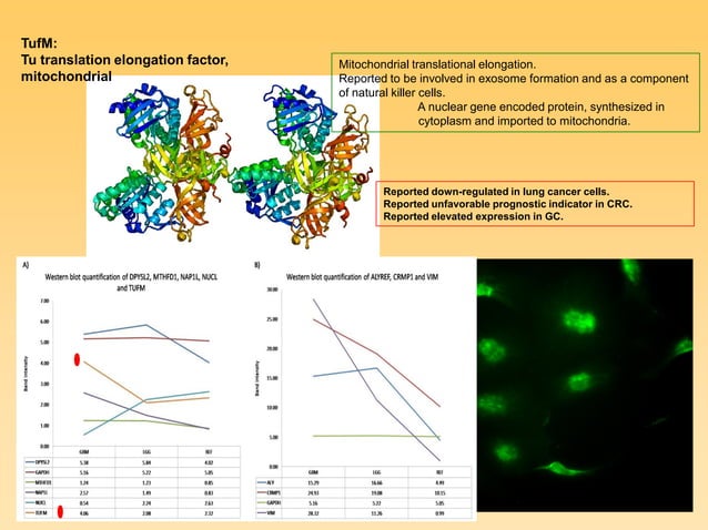 Functional Analysis Of Proteomic Biomarkers And Targeting Glioblastoma