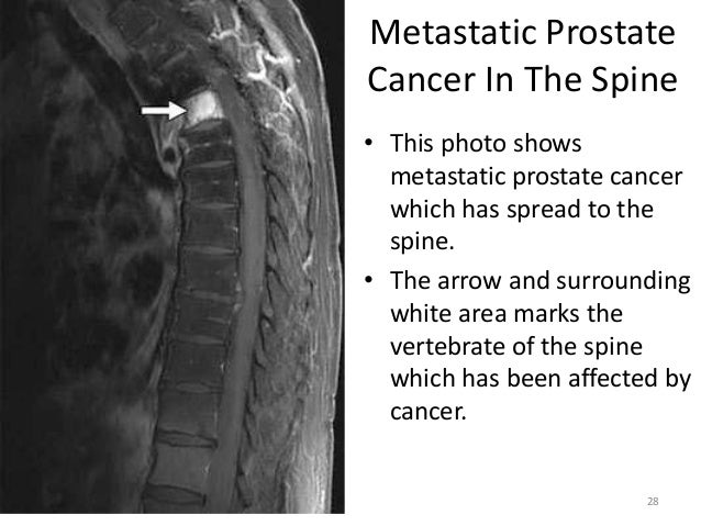 functional-anatomy-of-cancer