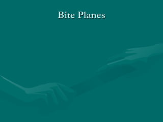 Bite Planes 