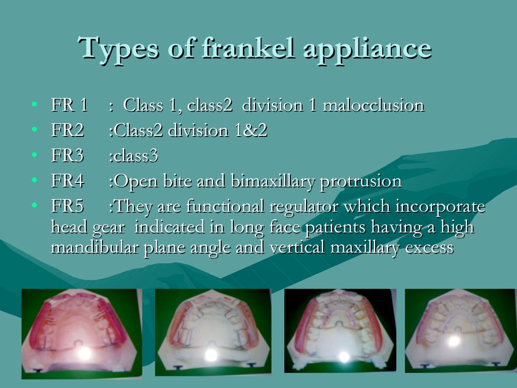 Functional Appliances