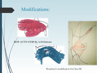 Modifications:
BOW ACTIVATOR By A.M.Schwarz
Wunderer’s modificaiton for Class III
 