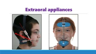 Extraoral appliances
 