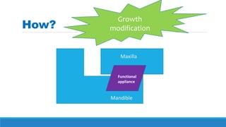 Mandible
Maxilla
Functional
appliance
How?
Growth
modification
 