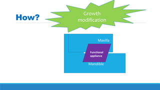 Mandible
Maxilla
Functional
appliance
How?
Growth
modification
 