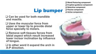 Lip bumper
 Can be used for both mandible
and maxilla.
 Uses the muscular force from
upper or lower lip to provide distal
force specially to molars.
 Remove soft tissues forces from
labial aspect which result increased
lower incisor inclination by influence
of tongue.
 In other word it expand the arch in
A-P direction.
 Mand Posturing component
 Eruption guidance component
 Retentive component
 Passive component
 Active component
 