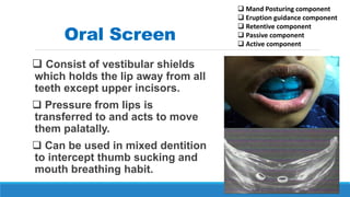 Oral Screen
 Consist of vestibular shields
which holds the lip away from all
teeth except upper incisors.
 Pressure from lips is
transferred to and acts to move
them palatally.
 Can be used in mixed dentition
to intercept thumb sucking and
mouth breathing habit.
 Mand Posturing component
 Eruption guidance component
 Retentive component
 Passive component
 Active component
 