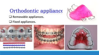 Orthodontic appliances
 Removable appliances.
 Fixed appliances.
 