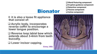 Bionator
 it is also a loose fit appliance
that consist of:
 Acrylic body, incorporates
reverse coffin to encourage a
lower tongue position.
 Reverse loop labial bow which
extends about 3-4mm from teeth
buccally.
 Lower incisor capping.
Eirew, 1981
 Mand Posturing component
 Eruption guidance component
 Retentive component
 Passive component
 Active component
 