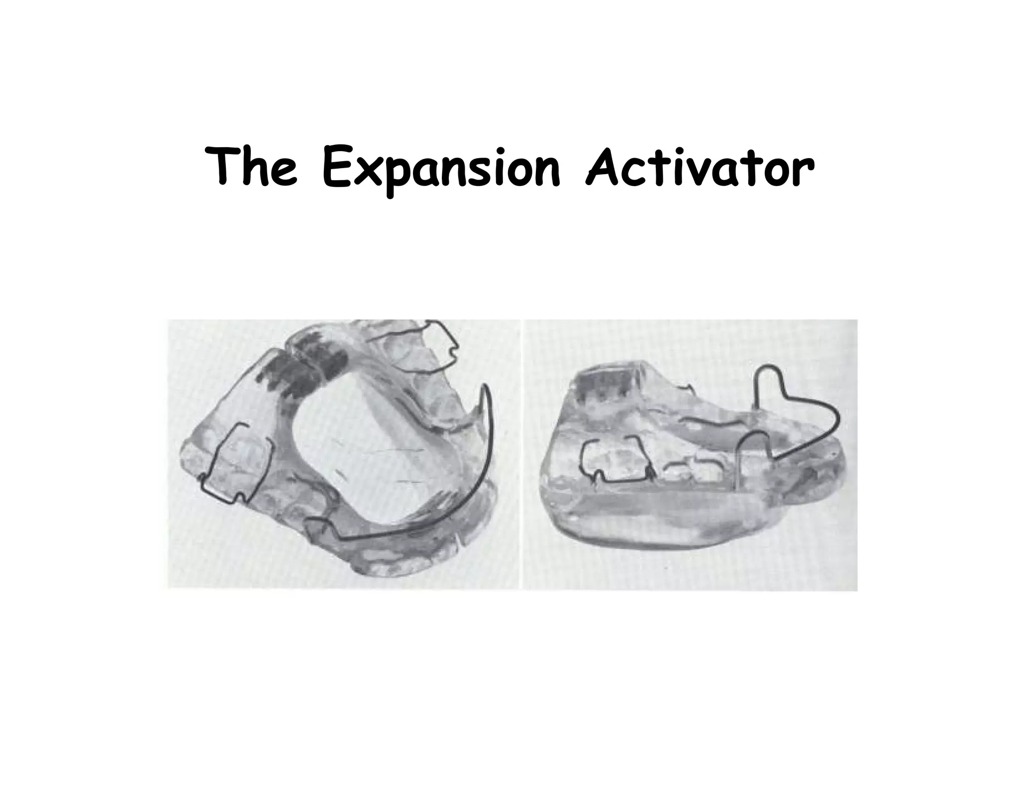 The Expansion Activator
 