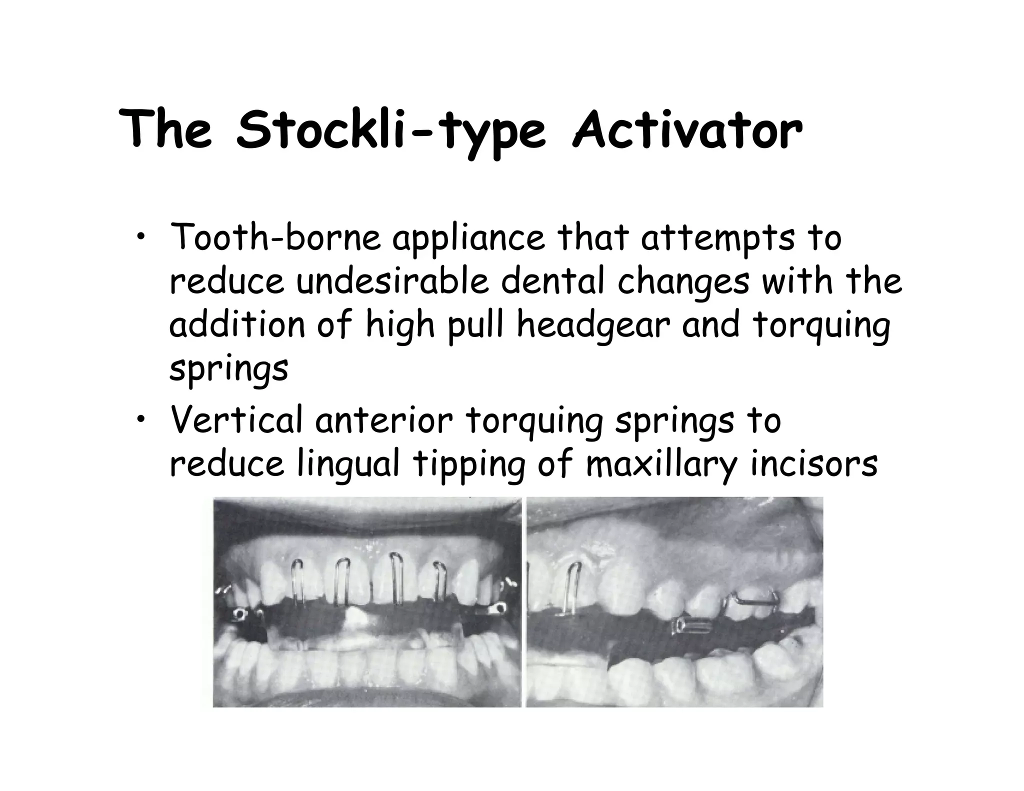 The Stockli-type Activator
• Tooth-borne appliance that attempts to
  reduce undesirable dental changes with the
  addition of high pull headgear and torquing
  springs
• Vertical anterior torquing springs to
  reduce lingual tipping of maxillary incisors
 