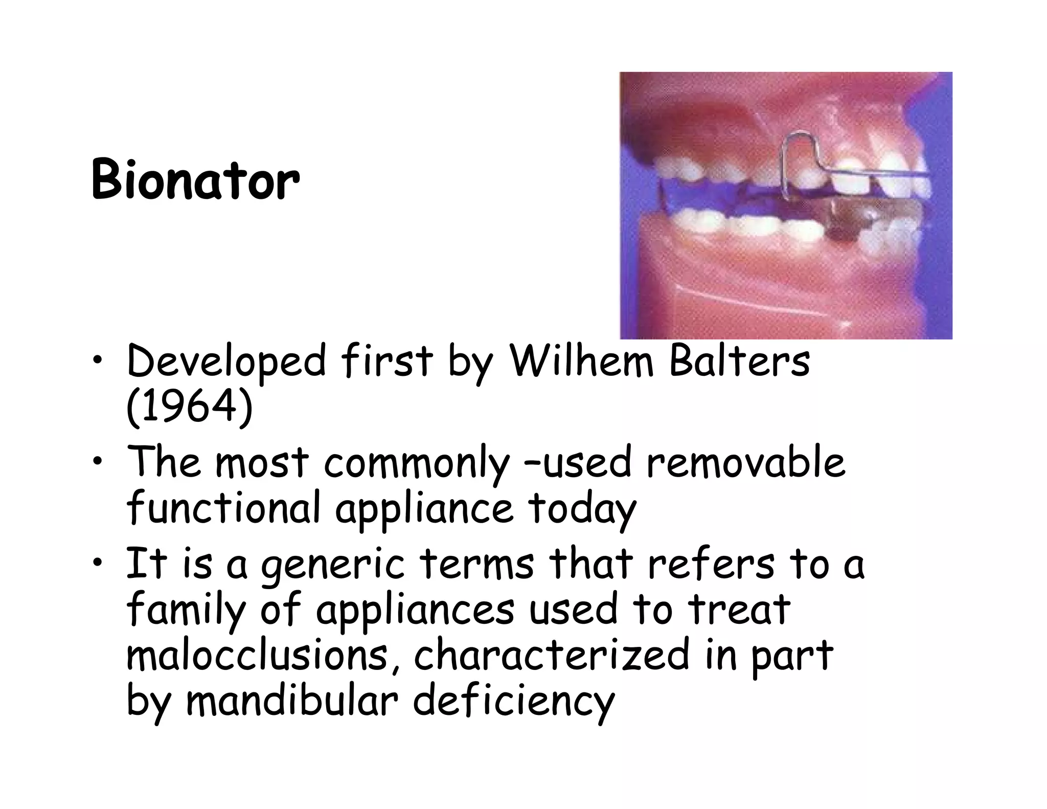 Bionator


• Developed first by Wilhem Balters
  (1964)
• The most commonly –used removable
  functional appliance today
• It is a generic terms that refers to a
  family of appliances used to treat
  malocclusions, characterized in part
  by mandibular deficiency
 