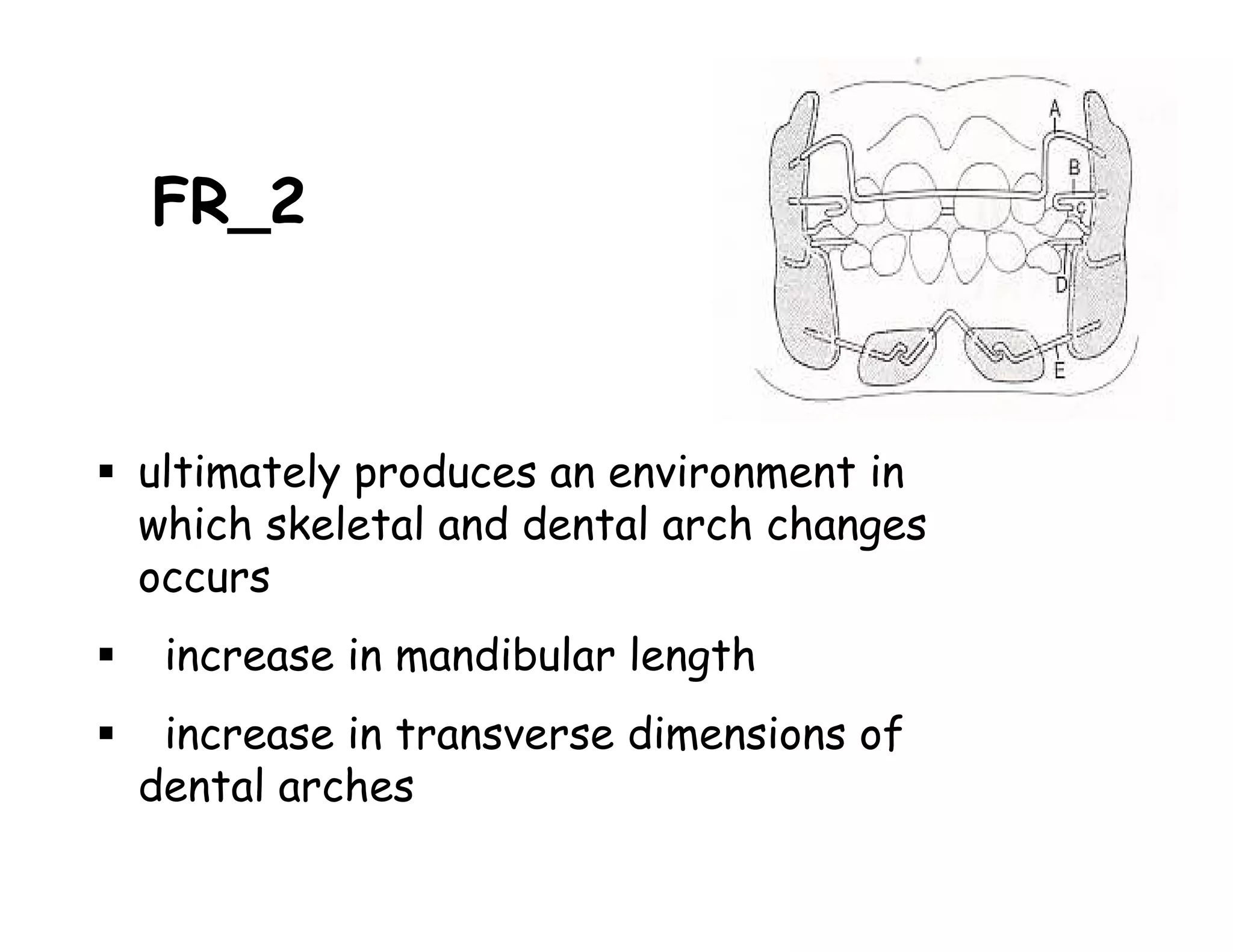 FR_2



ultimately produces an environment in
which skeletal and dental arch changes
occurs
 increase in mandibular length
 increase in transverse dimensions of
dental arches
 