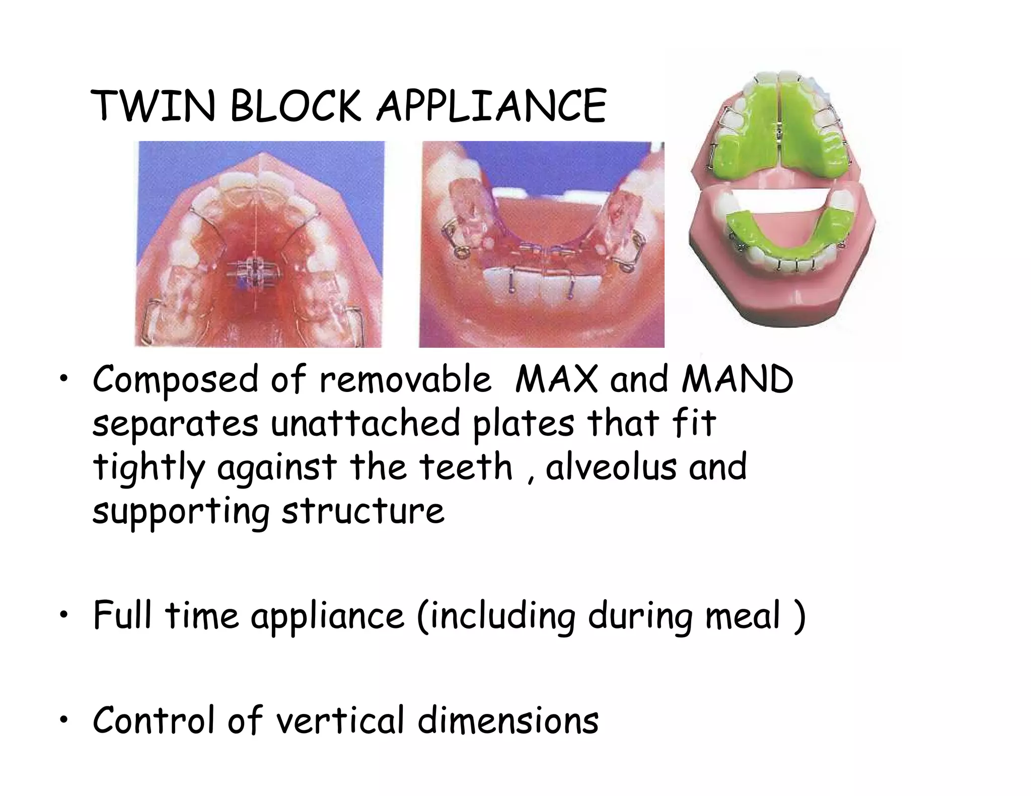 TWIN BLOCK APPLIANCE




• Composed of removable MAX and MAND
  separates unattached plates that fit
  tightly against the teeth , alveolus and
  supporting structure

• Full time appliance (including during meal )

• Control of vertical dimensions
 