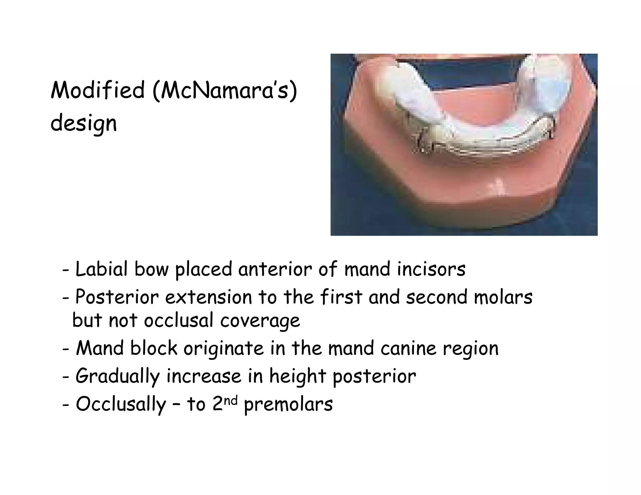Modified (McNamara’s)
design




- Labial bow placed anterior of mand incisors
- Posterior extension to the first and second molars
 but not occlusal coverage
- Mand block originate in the mand canine region
- Gradually increase in height posterior
- Occlusally – to 2nd premolars
 