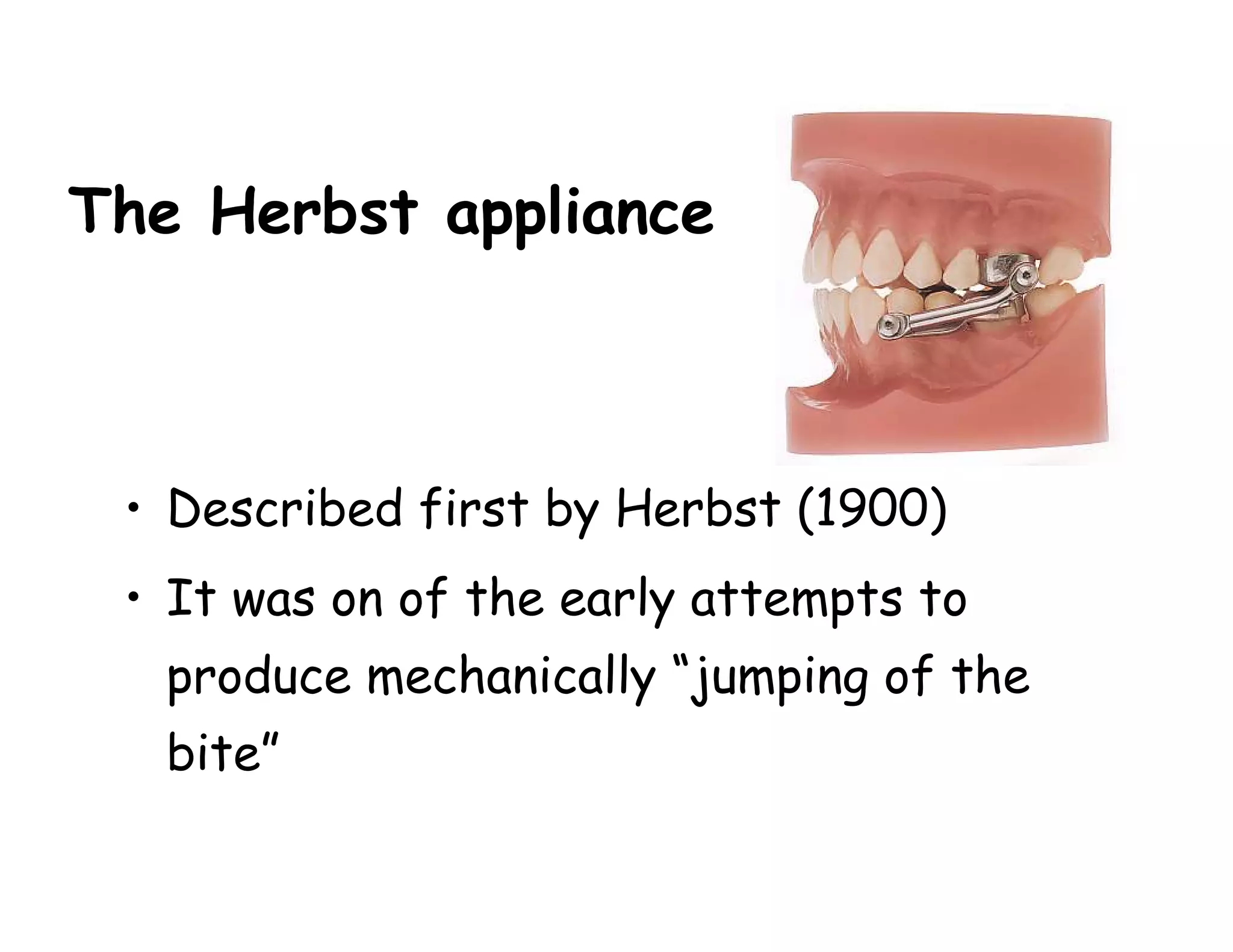 The Herbst appliance



 • Described first by Herbst (1900)
 • It was on of the early attempts to
   produce mechanically “jumping of the
   bite”
 