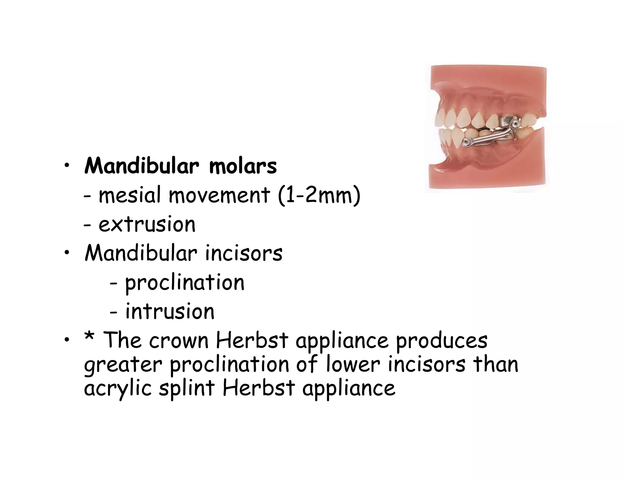 • Mandibular molars
  - mesial movement (1-2mm)
  - extrusion
• Mandibular incisors
     - proclination
     - intrusion
• * The crown Herbst appliance produces
  greater proclination of lower incisors than
  acrylic splint Herbst appliance
 