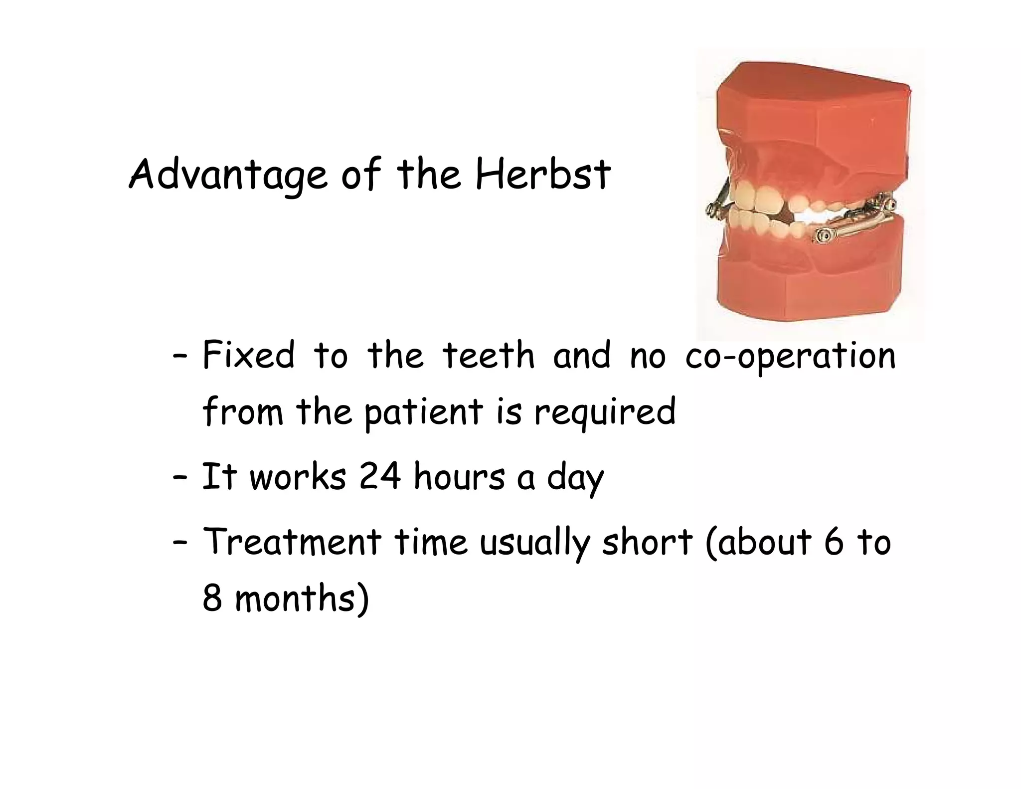 Advantage of the Herbst



  – Fixed to the teeth and no co-operation
   from the patient is required
  – It works 24 hours a day
  – Treatment time usually short (about 6 to
   8 months)
 