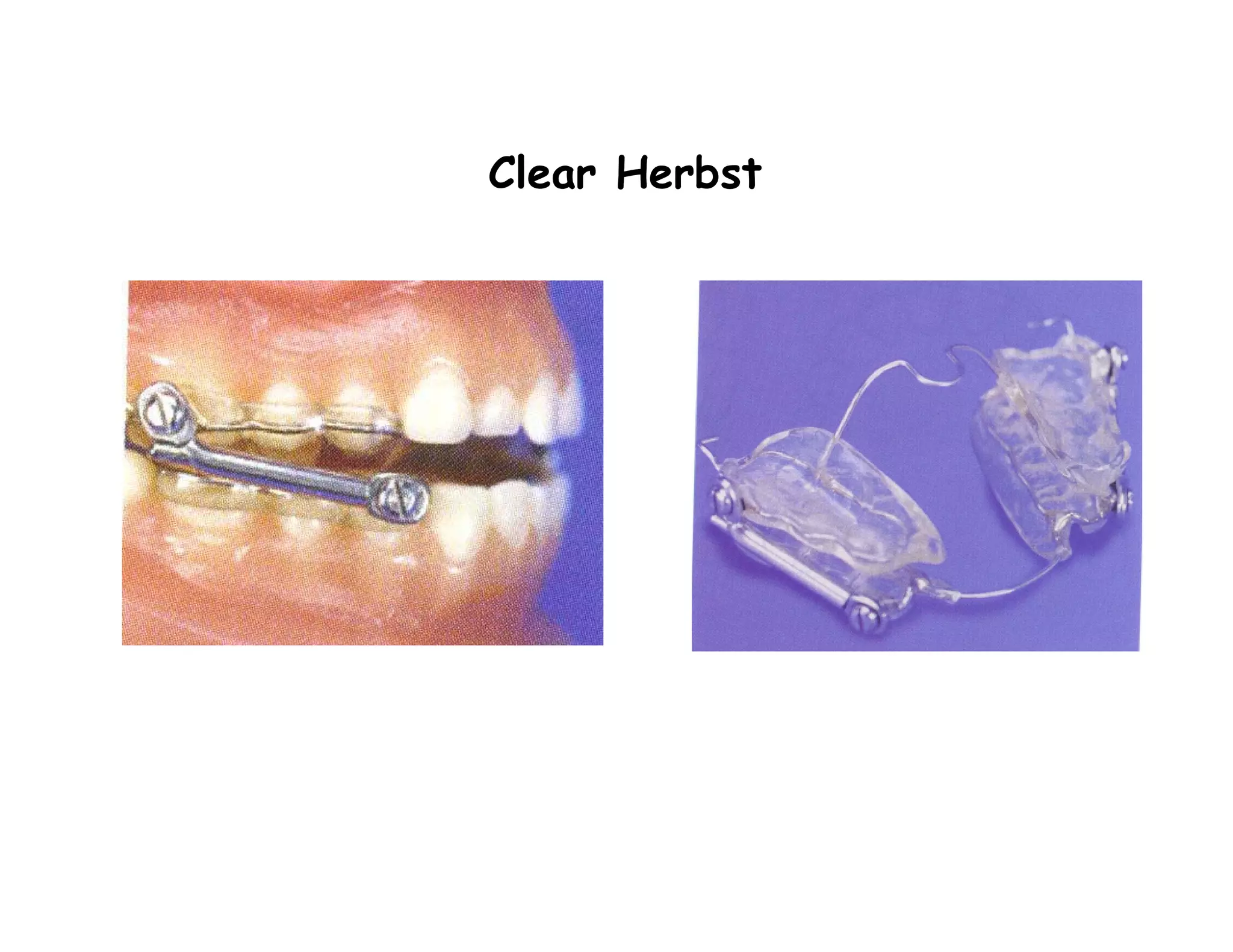 Clear Herbst
 