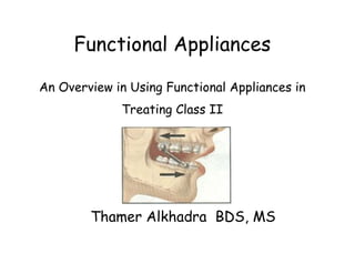 Functional Appliances

An Overview in Using Functional Appliances in
             Treating Class II




        Thamer Alkhadra BDS, MS
 