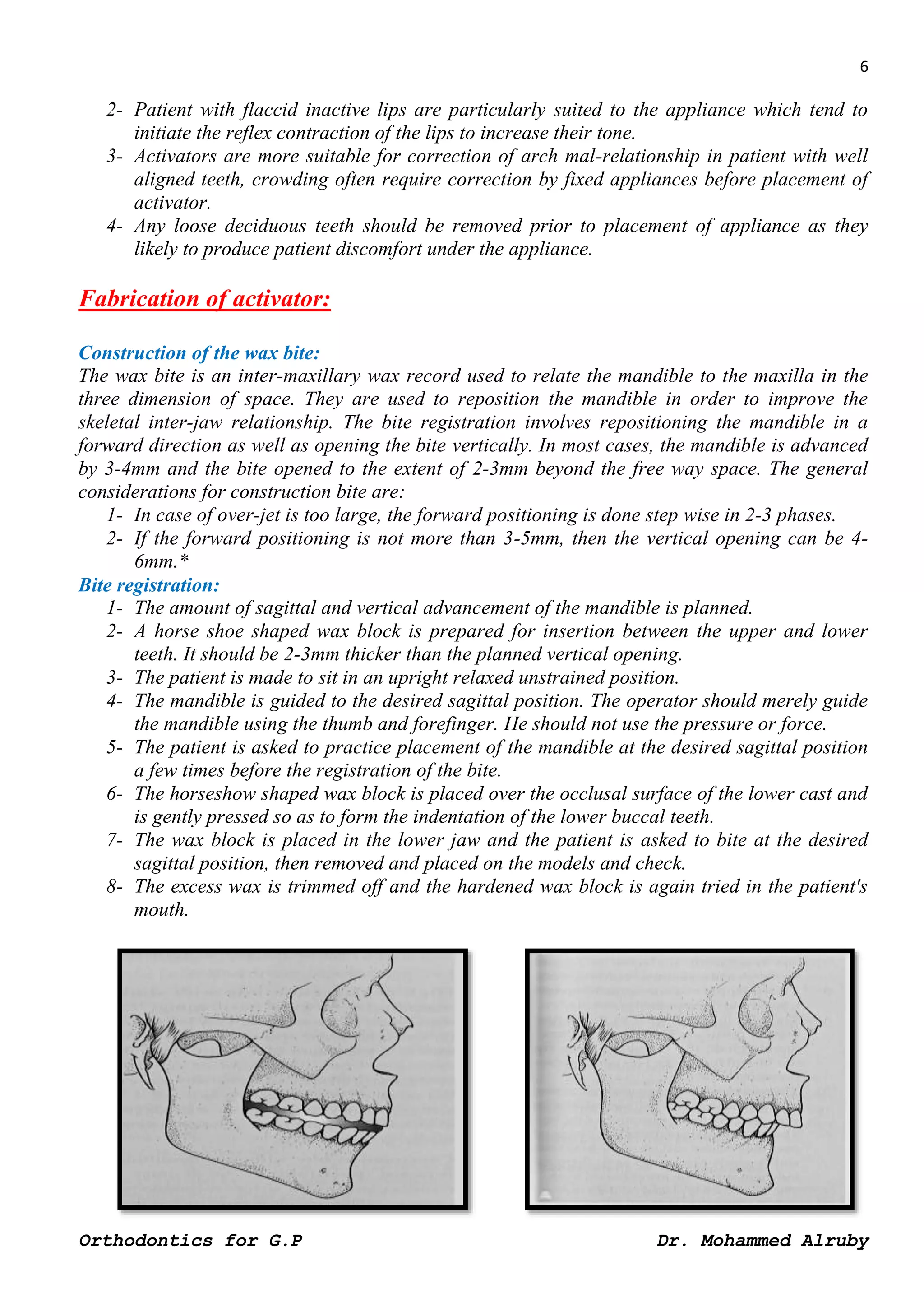 functional appliances for general practitioners.docx