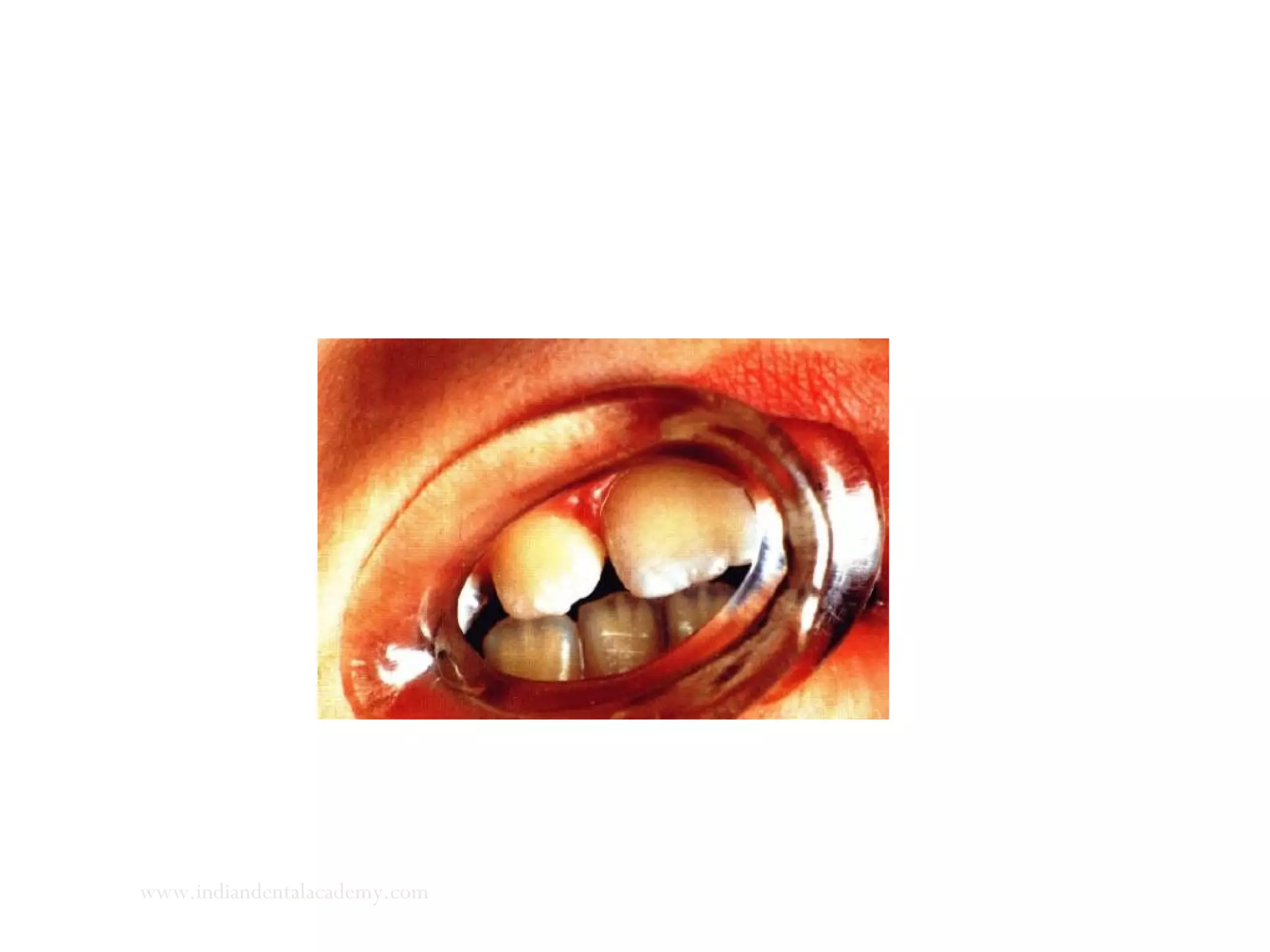 www.indiandentalacademy.com
 