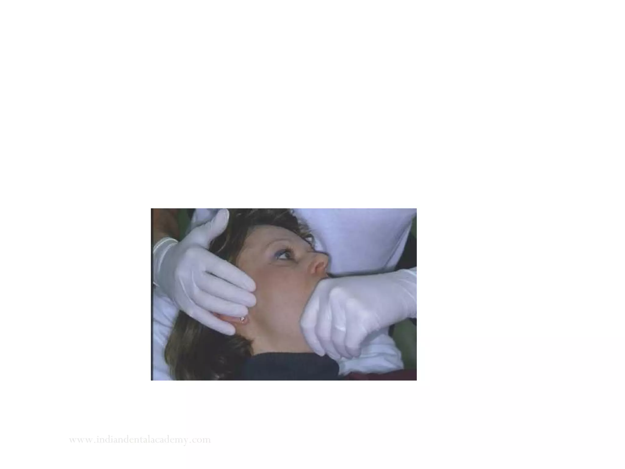 Medial pterygoid: palpated at their insertions on the medial
surfaces of the mandibular angles. The finger tips are placed at
the inferior borders of the mandible and lightly rolled medially
and superiorly.
www.indiandentalacademy.com
 