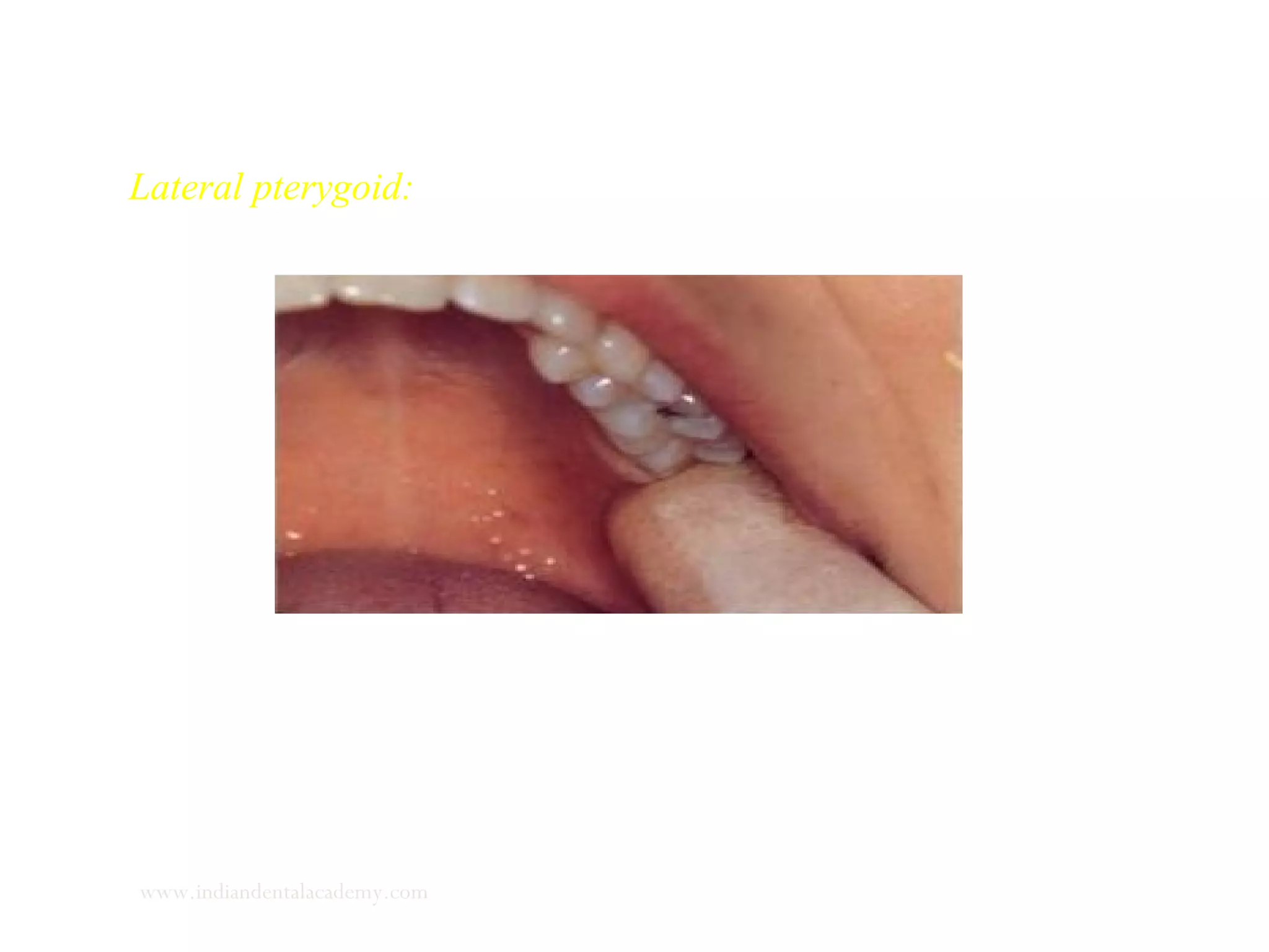 Lateral pterygoid:
www.indiandentalacademy.com
 