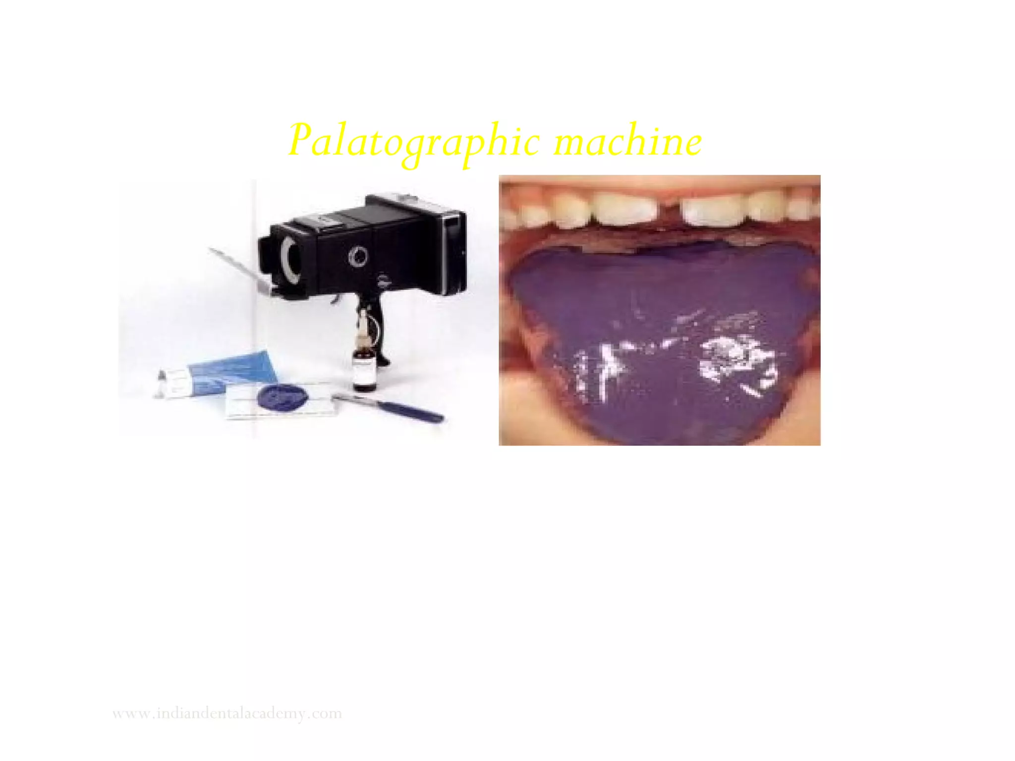 Palatographic machine
www.indiandentalacademy.com
 