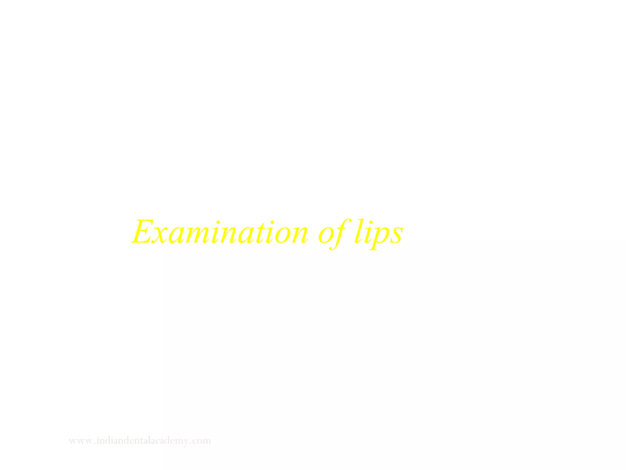 Examination of lips
www.indiandentalacademy.com
 