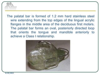 The palatal bar is formed of 1.2 mm hard stainless steel
wire extending from the top edges of the lingual acrylic
flanges in the middle area of the deciduous first molars.
The palatal bar forms an oval, posteriorly directed loop
that orients the tongue and mandible anteriorly to
achieve a Class I relationship.
6/29/2021
 